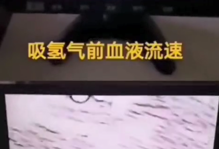 吸氫前後的血液流速變化